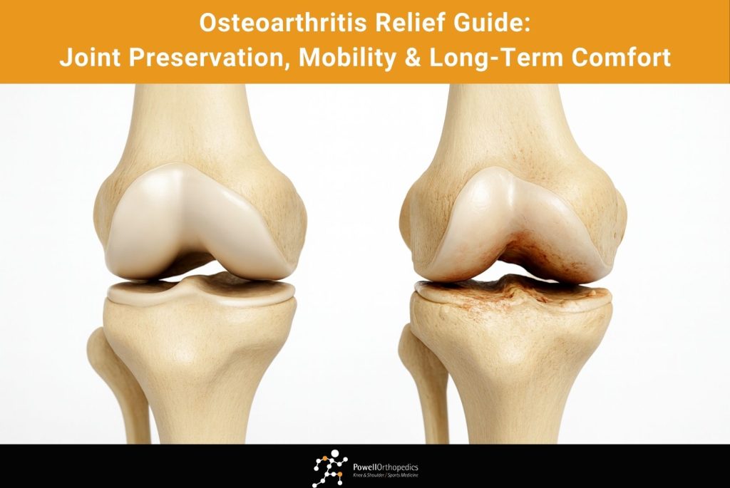 Osteoarthritis Relief Guide Joint Preservation, Mobility & Long-Term Comfort